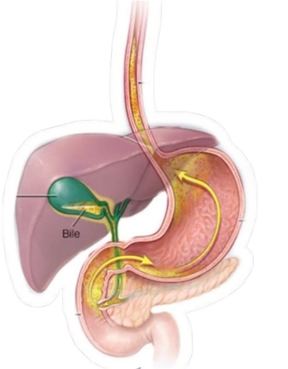 Taller Desintoxicacion hepaticobiliar, limpia tu higado<br />
