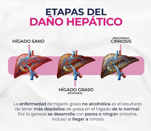 Taller online limpia tu higado